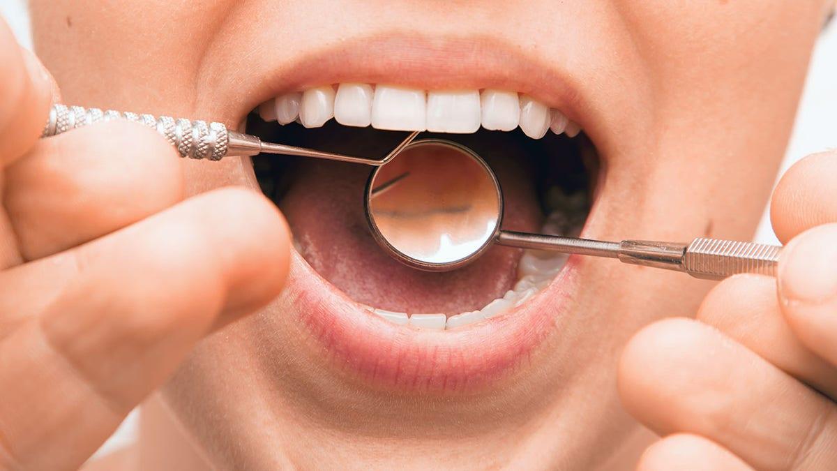 英文外刊阅读: Why do my gums bleed after I brush my teeth, and what should I do about it?